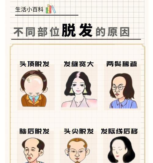 掉头发的原因与解决方法（深入探究头发脱落的原因及有效的预防方法）