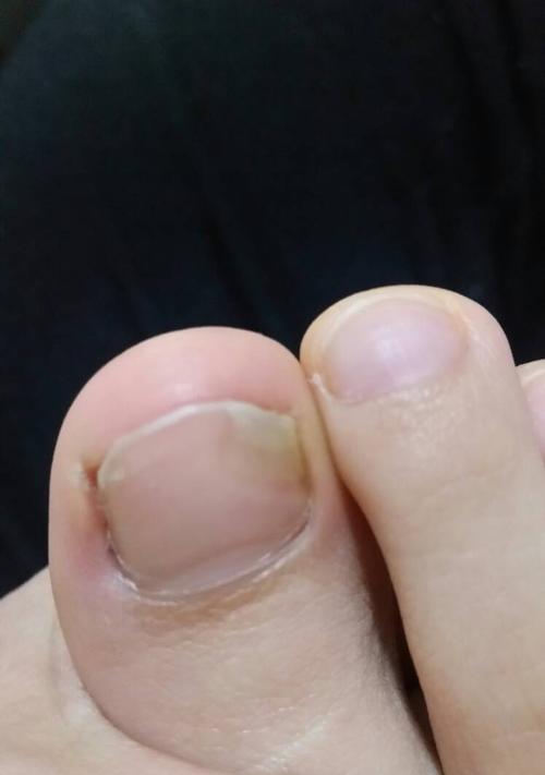 油烟机黄斑的清洗技巧（掌握正确的清洗方法）