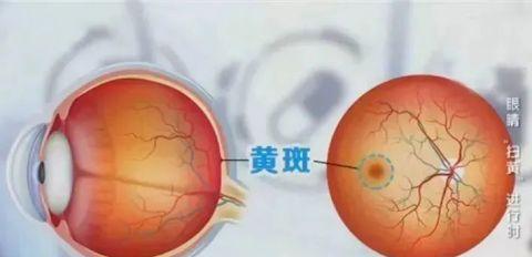 笔记本电脑伤眼怎么办？有效解决方法有哪些？