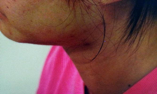如何检查电脑显示器是否存在亮点？