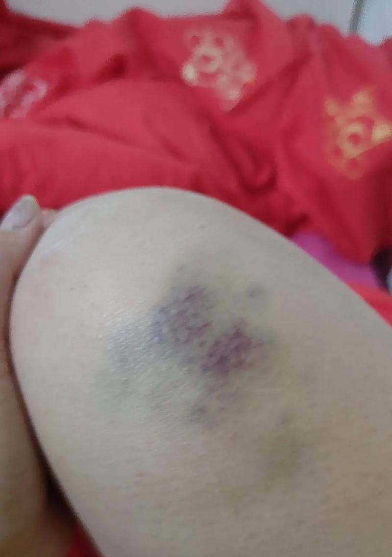 手机拍照时摔倒了照片还能恢复吗？