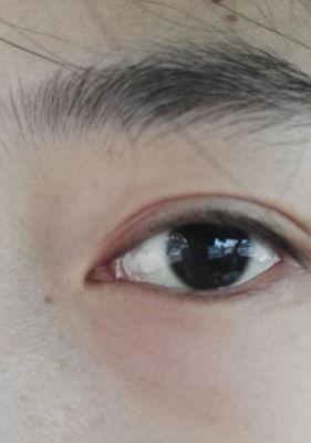 如何使用手机拍出清晰眼睛照片？有哪些技巧？