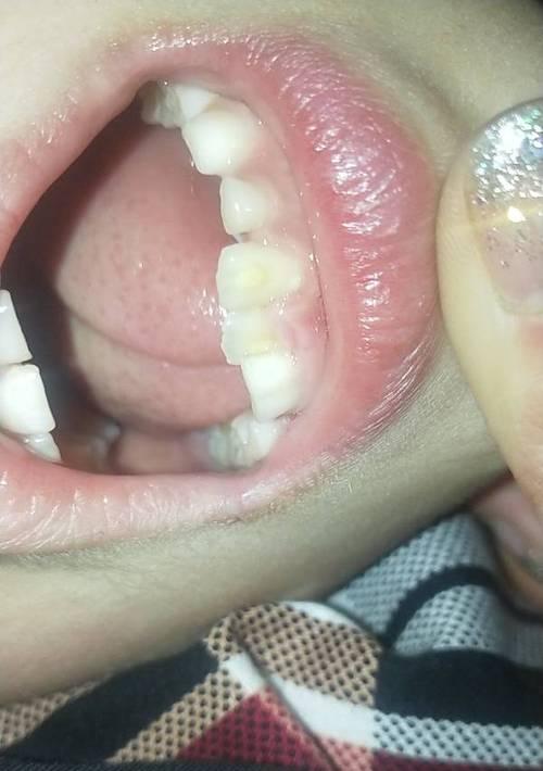 用手机怎么拍牙齿照片？有哪些拍摄技巧？