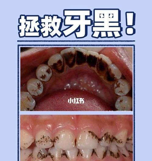 用手机怎么拍牙齿照片？有哪些拍摄技巧？